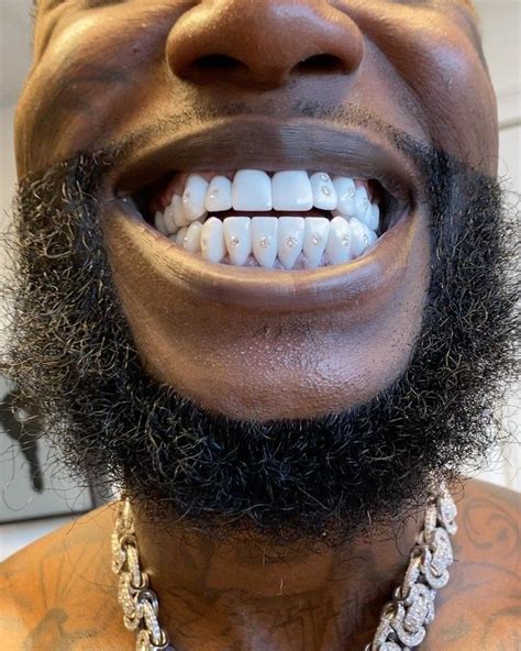 gucci mane fake teeth|gucci mane teeth price.